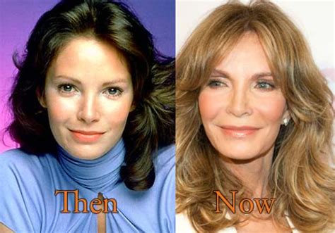 Jaclyn Smith Plastic Surgery Before And After Facelift Filler Pictures