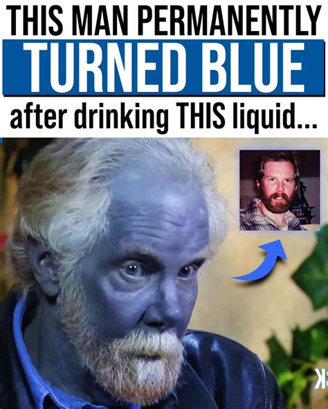 Project Nightfall He Turned Blue After Drinking This Common Liquid