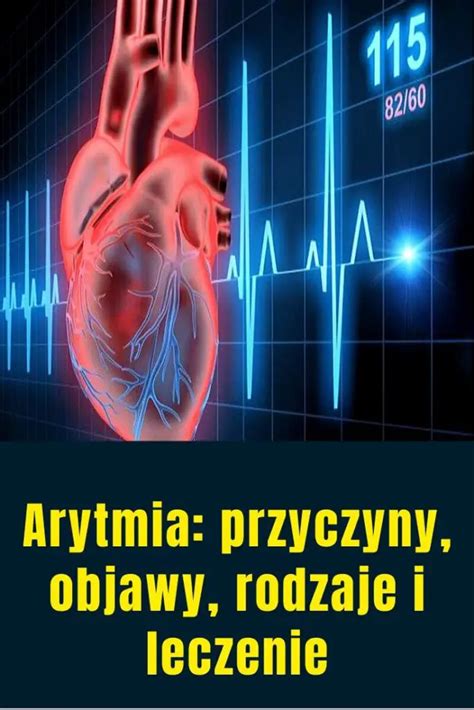 Arytmia Przyczyny Objawy Rodzaje I Leczenie