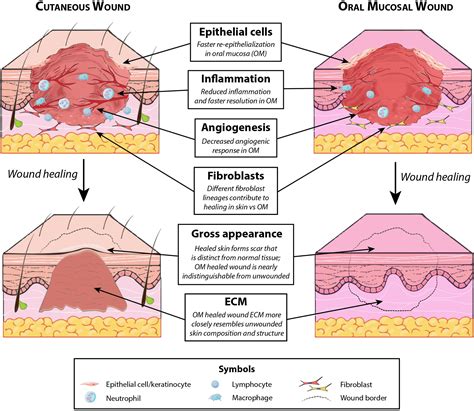 Wound Infection Diagram