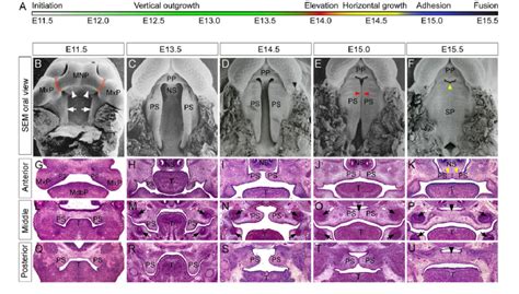 Palatogenesis In The Mouse A Timecourse Of Palate Development In