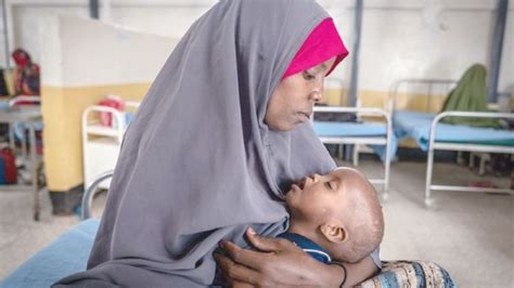 Somali Children Are Starving To Death Report Tripoli Post