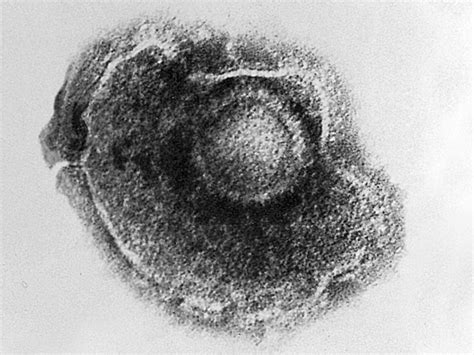 Filevaricella Zoster Virus Embryology