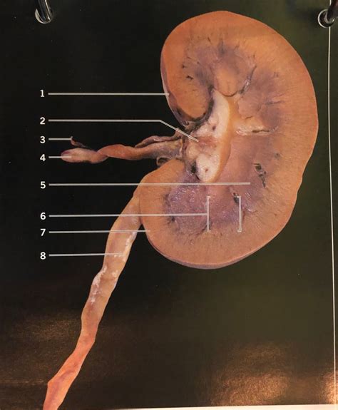 Sheep Kidney Frontal Section Diagram Quizlet