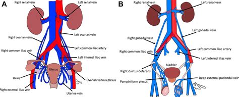 The Clinical Problem Of Pelvic Venous Disorders Interventional