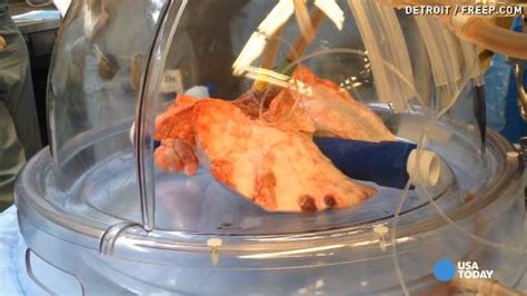 Machine That Keeps Lungs Alive Outside Body Tested