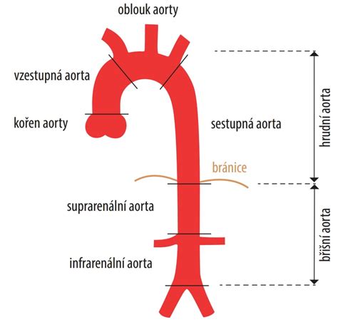 12 Onemocnění aorty srdečnice Nemocnice Na Homolce