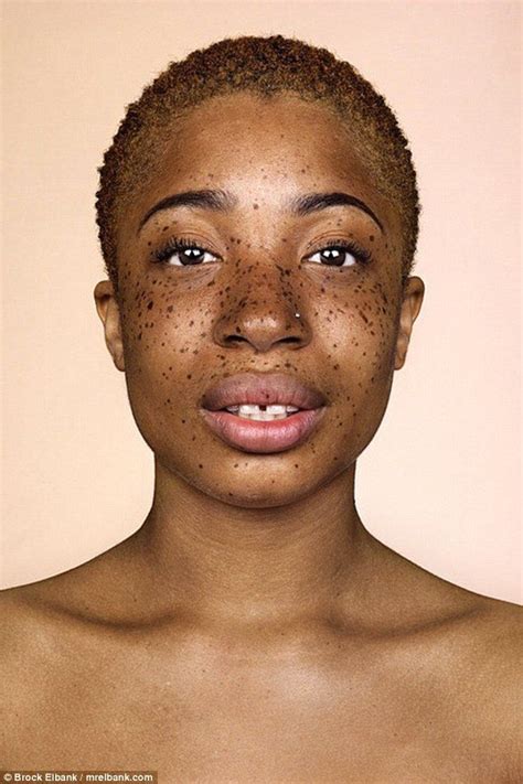 Photographer Captures Freckles In All Their Glory People With