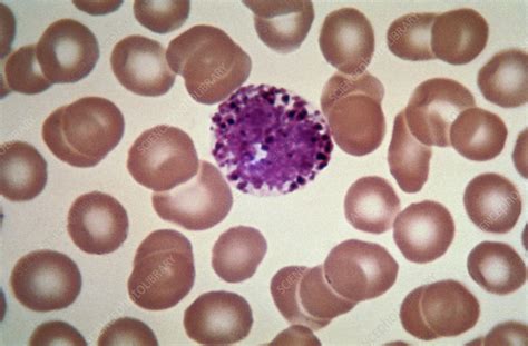 Eosinophil Lm Stock Image C0222164 Science Photo Library