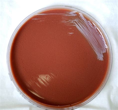 Free Picture Gram Negative Burkholderia Mallei Bacteria Grown