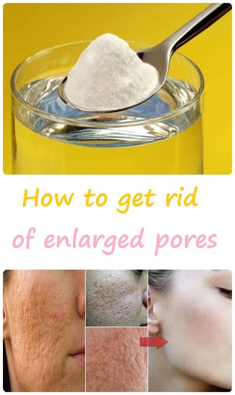 How To Get Rid Of Enlarged Pores Top 5 Diy