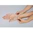 Wrist And Hand Physiotherapy  Harpenden