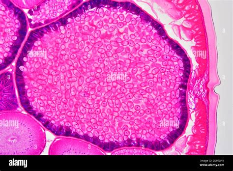 Ascaris Lumbricoides Male And Female Cross Section