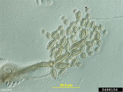 Cladosporium Fungi Cladosporium Spp On Peony Paeonia Spp 5488156