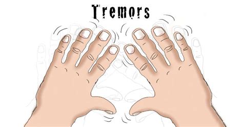 Tremor Causes Symptoms Diagnosis And Treatment Natural Health News