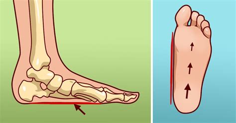 10 Reasons For Foot Pain And How To Fix It