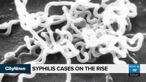 Syphilis Cases Increasing In Manitoba Video Citynews Winnipeg