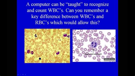 Interpretation Of Total White Blood Cell Count And Differential Youtube