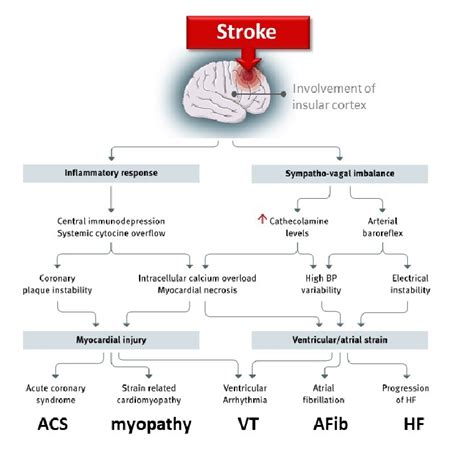Stroke As Interdisciplinary Disease What The Practising Cardiologist