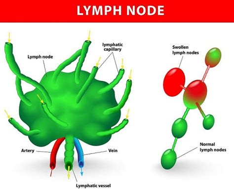 Check spelling or type a new query. Activate Your Body's Anti-Cancer Lymphatic System by ...