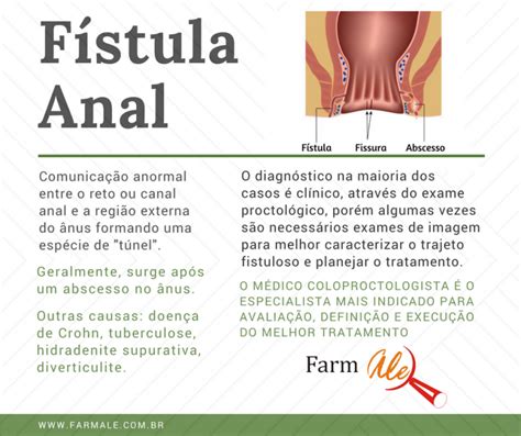 Fístula Anal Farmale