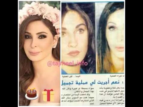 عمليات التجميل في كوريا الجنوبية plastic surgery. اليسا قبل وبعد | اكتشفوا طريقة مكياج اليسا بالصور(اليسا ...