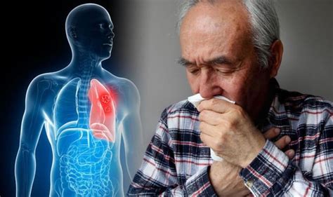 Lung Cancer Symptoms Coughing Blood Could Be Sign Of The Deadly