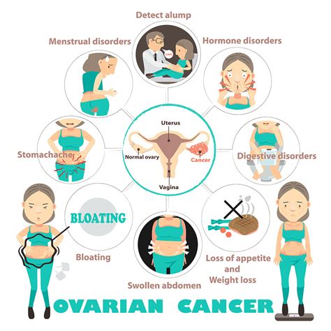 Signs Symptoms Of Ovarian Cancer Premier Oncology