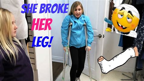 She Broke Her Leg Day 086 03 27 17 Youtube