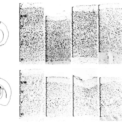 Neuronal expression of the p75 N TR -ICD leads to the loss of neurons