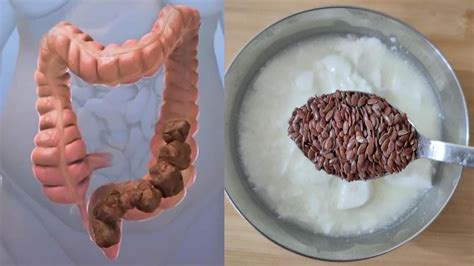 Cleanse Your Colon With Only 2 Ingredients Colon Cleanse At Home Youtube