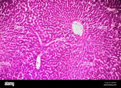 Human Liver Tissue Under Microscope Stock Photo Alamy