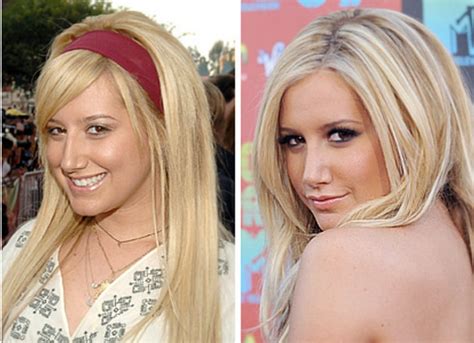 Ashley Tisdale Before And After Her Nose Job Plastic Surgery Photos