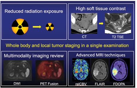 Know The Differences Between Ct Scan Pet And Mris Hot Sex Picture