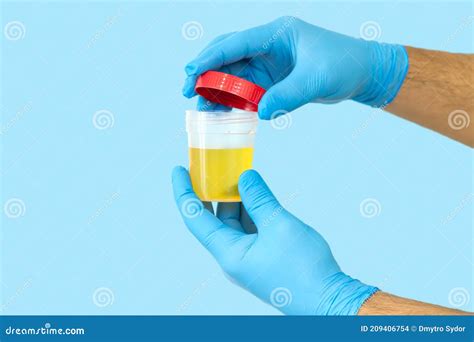 Nurse Opening Urine Sample Container For Medical Urinalysis Stock Photo