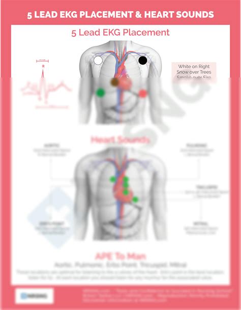 Solution Cardiac Lead Ekg Placement Studypool