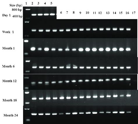 Pcr Product 487 Bp For Actin Gene Amplified From Bed Bug