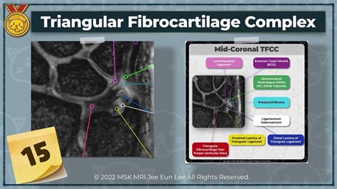 Anatomy15 Triangular Fibrocartilage Complex Tfcc Wrist Mri Youtube