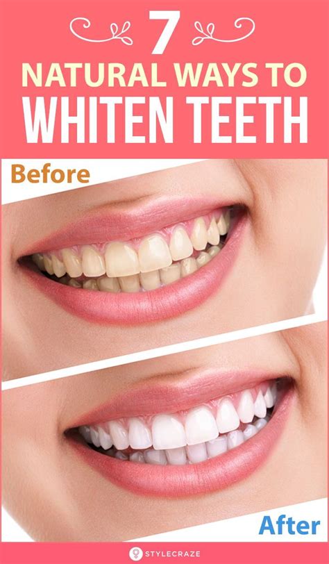 How To Get Rid Of White Spots On Teeth Fab How Reverasite