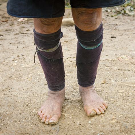 Hmong Feet Sapa Vietnam Hmong Who Live In North Vietnam Flickr