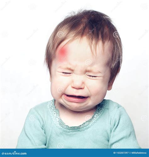 Little Baby With Bruise Crying Medical Concept Stock Image Image Of
