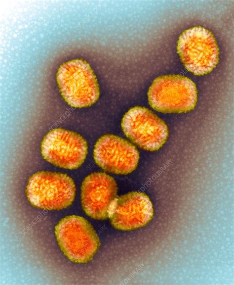 Molluscum Contagiosum Virus Tem Stock Image C0153917 Science