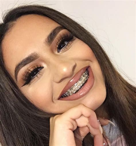 Cute Braces Colors Braces Girls Adult Braces Full Face Makeup Skin