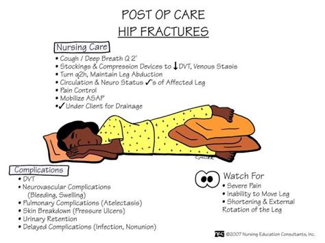 Post Op Care Of Hip Fractures Medical Surgical Nursing Surgical