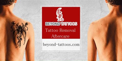 If you're using a spray you can transfer it to a small spray bottle with a nozzle to make it easier to bag. Tattoo Removal - Unwanted tattoos can be removed gradually ...