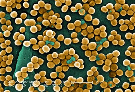 5 Facts You Should Know About Mrsa And Mrsa Cleanup Aftermath Services