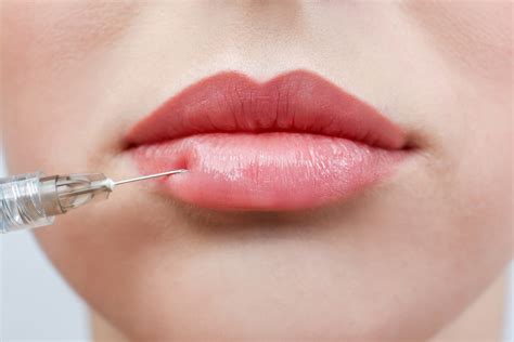 Types Of Lip Fillers Different Brands Best Ones And How They Work