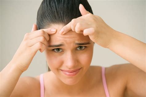 Rash On Forehead Causes Treatment Pustular Rash On Forehead Treatment