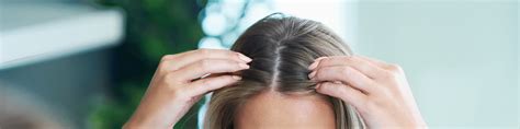 They are commonly misdiagnosed and can present with itch and inflammation. DS Laboratories: How Inflammation Affects Hair Loss | Milled
