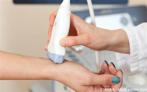 Apr 24, 2017 · an can affect many organs and cause an array of symptoms. Ultraschall in der Neuropathie-Diagnostik sinnvoll | Gelbe ...